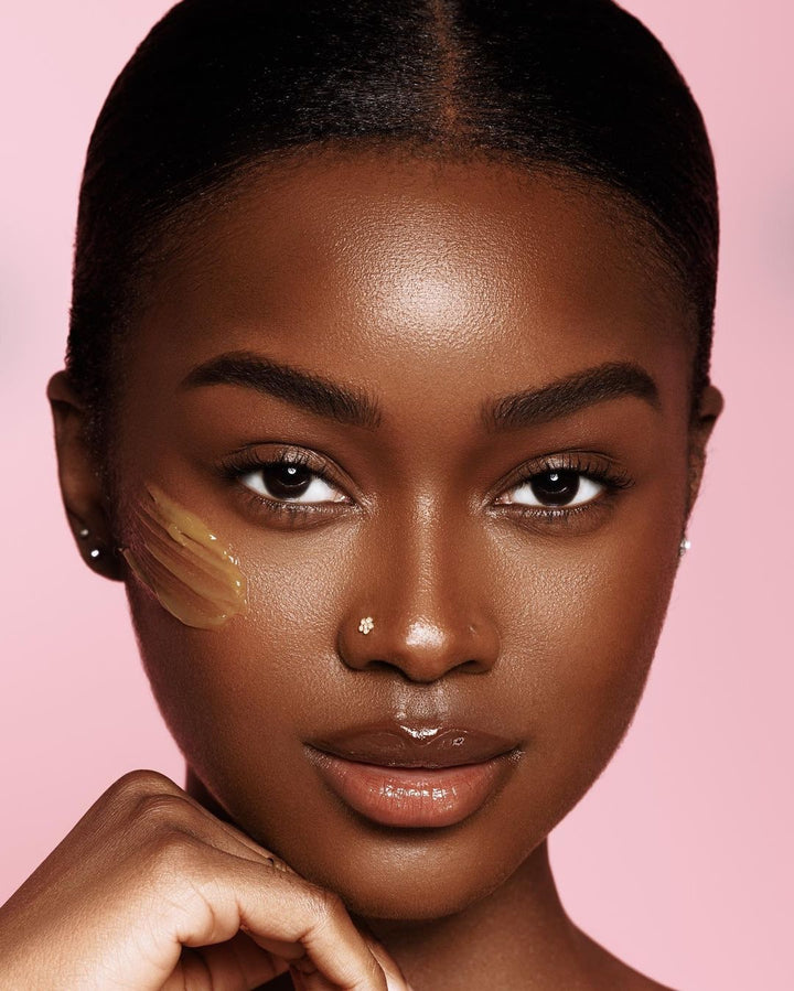 Dark Spots & Hyperpigmentation
